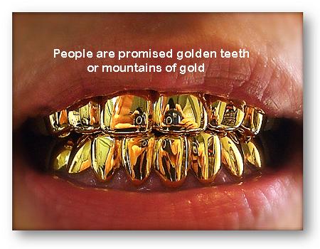 golden teeth