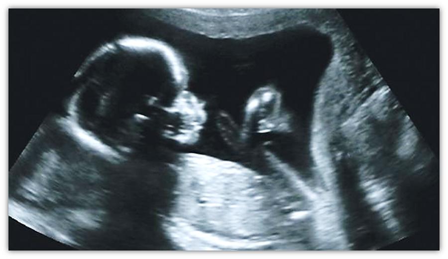baby in womb